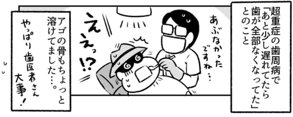 20年くらい歯医者さんに行かなかった結果　なるあすく（@naruasuku）さん提供