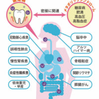 「腸活」の盲点は口腔ケア　お口の中の悪玉菌が腸内環境に影響