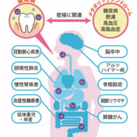 「腸活」の盲点は口腔ケア