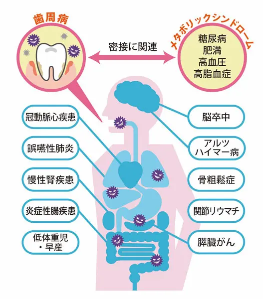 「腸活」の盲点は口腔ケア　お口の中の悪玉菌が腸内環境に影響