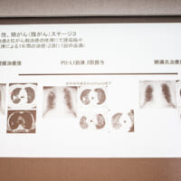 ICIによるがん免疫療法のいまとこれから