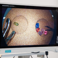「腹腔鏡鉗子」を用いた作業を疑似体験する様子。遠隔モニター越しに患部に見立てたビーズを移し替える