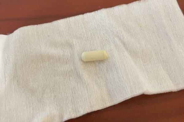 小学生の耳からシャーペン消しゴム　耳鼻科で無事摘出