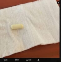 無事に摘出