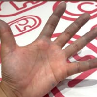 手が青い