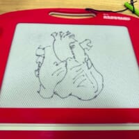 子どもに「ハート描いて」と頼まれた心臓外科医 ガチすぎる“ハート”を描き上げる