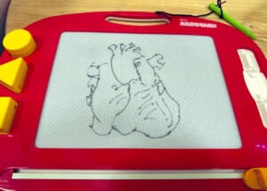 子どもに「ハート描いて」と頼まれた心臓外科医 ガチすぎる“ハート”を描き上げる