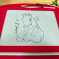 子どもに「ハート描いて」と頼まれた心臓外科医 ガチすぎる“ハート”を描き上げる